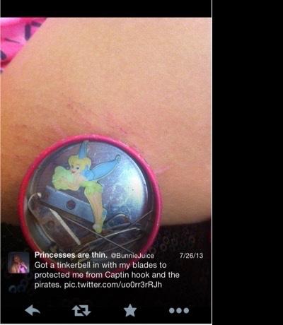 @BunnieJuice shares an image of some of her self-harm cuts on her arm. Also in the image are the blades she uses to harm herself, in a Tinker Bell themed case.