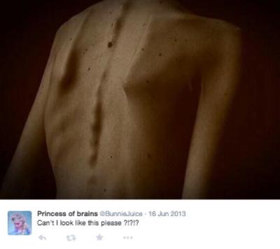 Princess of brains shares an image of a person's back on Twitter. The person in the image has a thin back. Their backbone, rib bones, and shoulder blades protrude from their skin in a way that indicates their thinness. Princess of brains expresses a jealousy in her tweet, saying, "Can't I look like this please?"